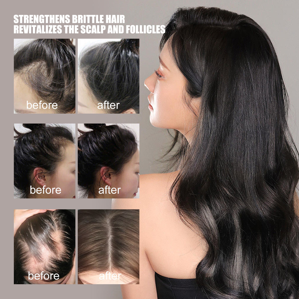 30ml Hair Growth Essence for Strong, Thick Hair Care